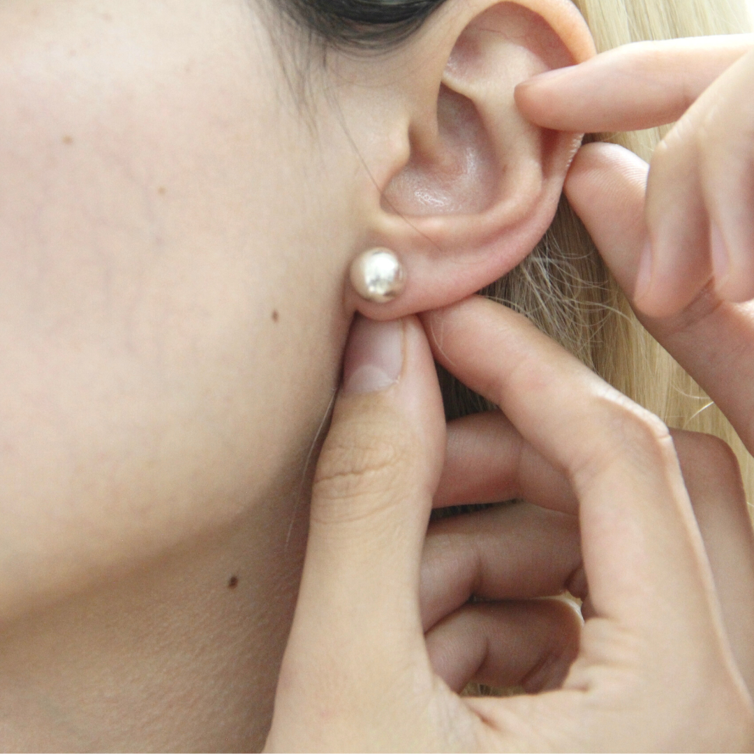 Aretes Esfera